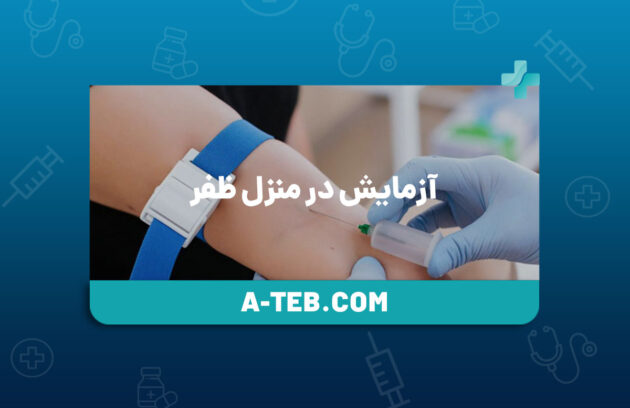 آزمایش در منزل ظفر