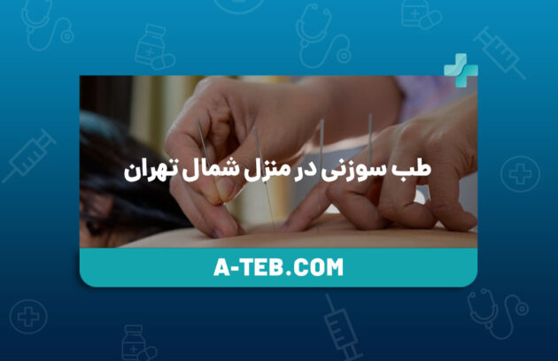 طب سوزنی در منزل شمال تهران