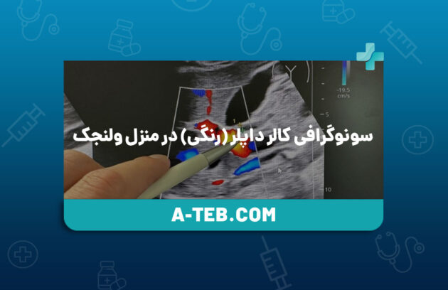 سونوگرافی کالر داپلر در منزل ولنجک
