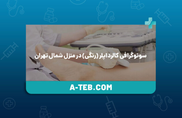 سونوگرافی کالرداپلر (رنگی) در منزل شمال تهران
