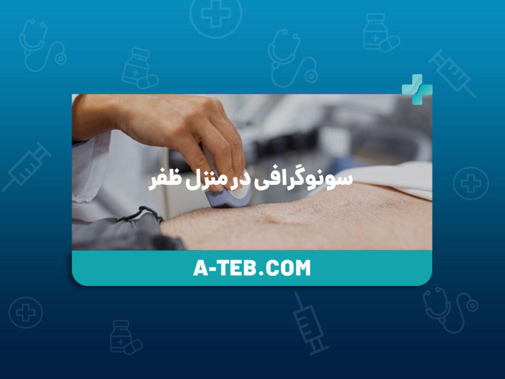 سونوگرافی در منزل ظفر