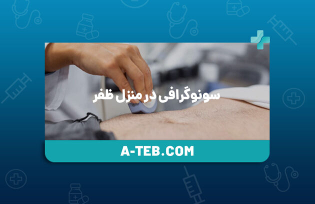سونوگرافی در منزل ظفر