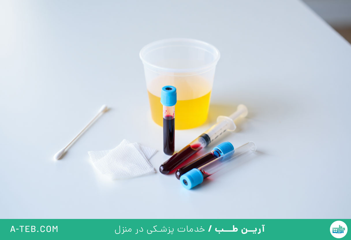 آزمایش در منزل ونک