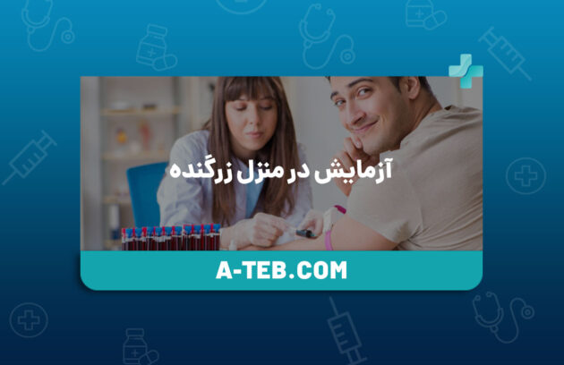 آزمایش در منزل زرگنده