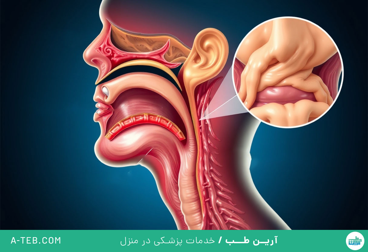 خلط پشت حلق