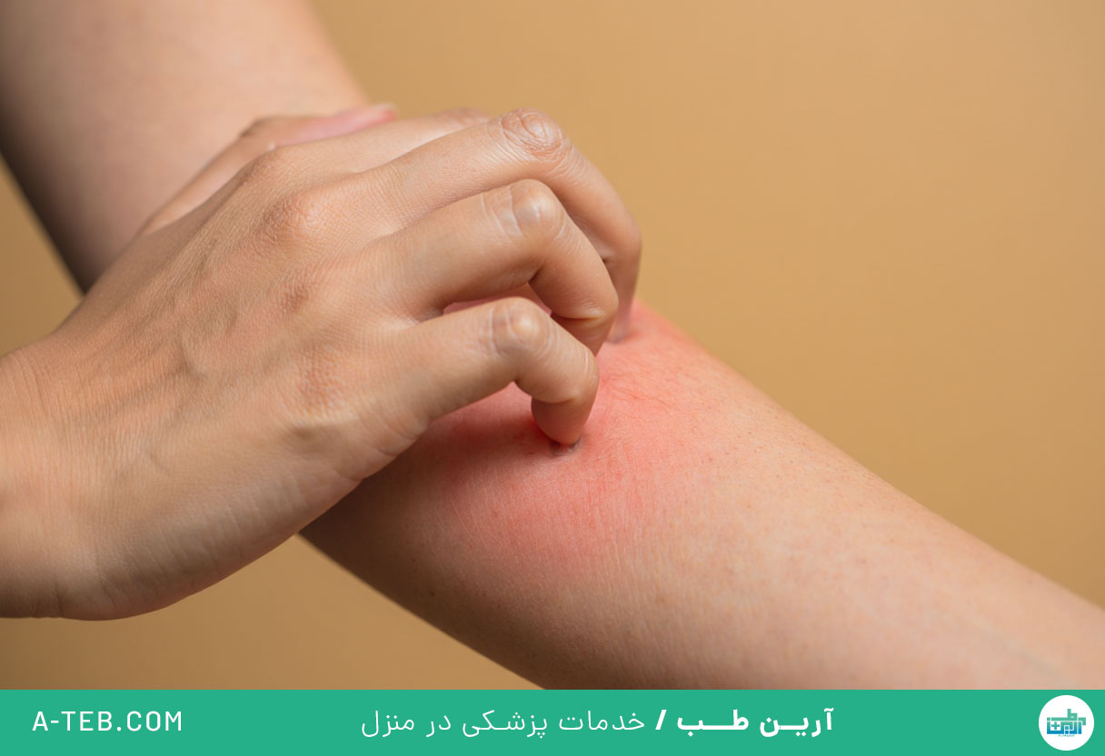 خارش بدن