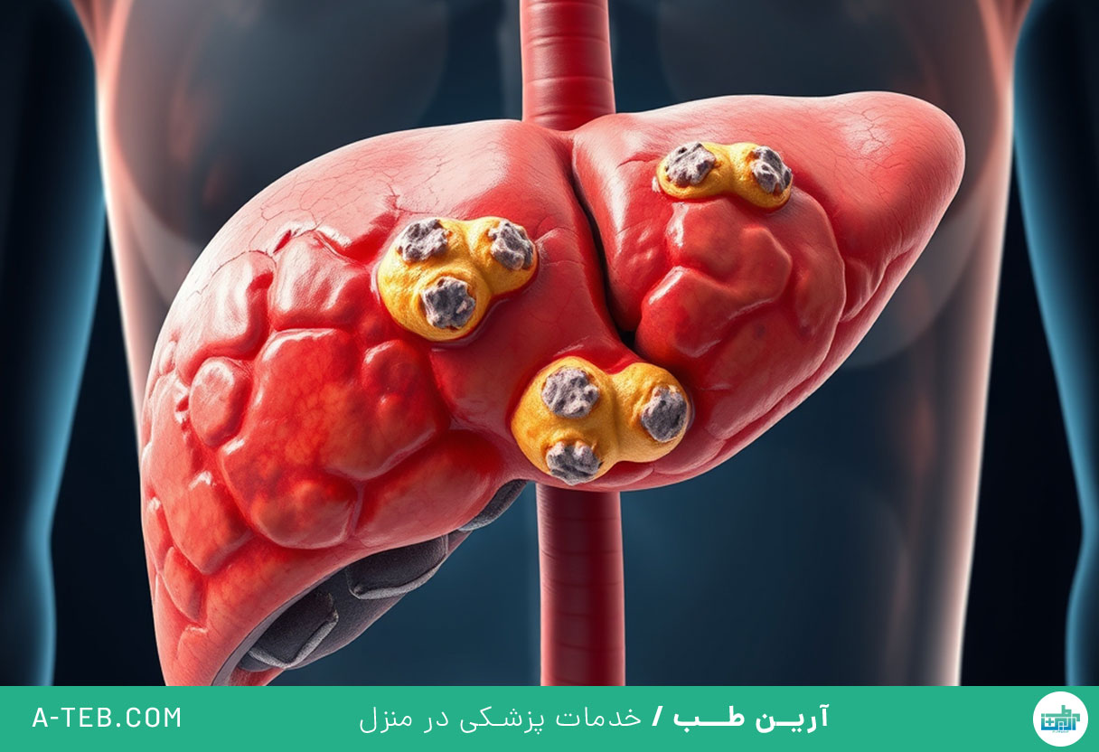 التهاب معده