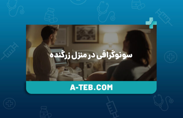 سونوگرافی در منزل زرگنده