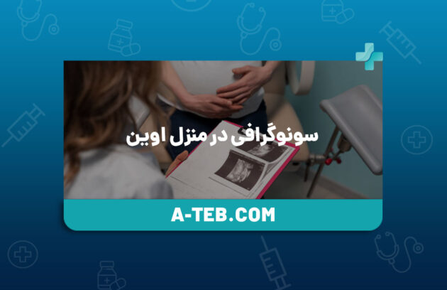سونوگرافی در منزل اوین