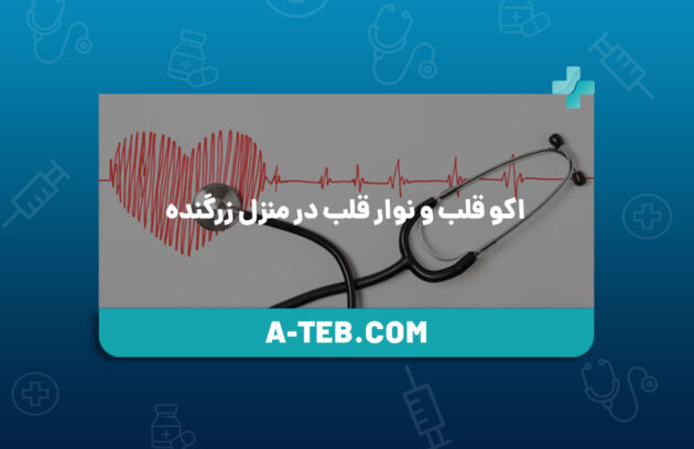 اکو قلب و نوار قلب در منزل زرگنده