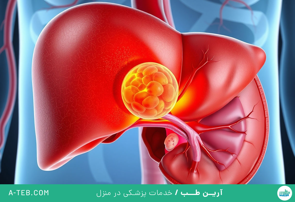 التهاب معده