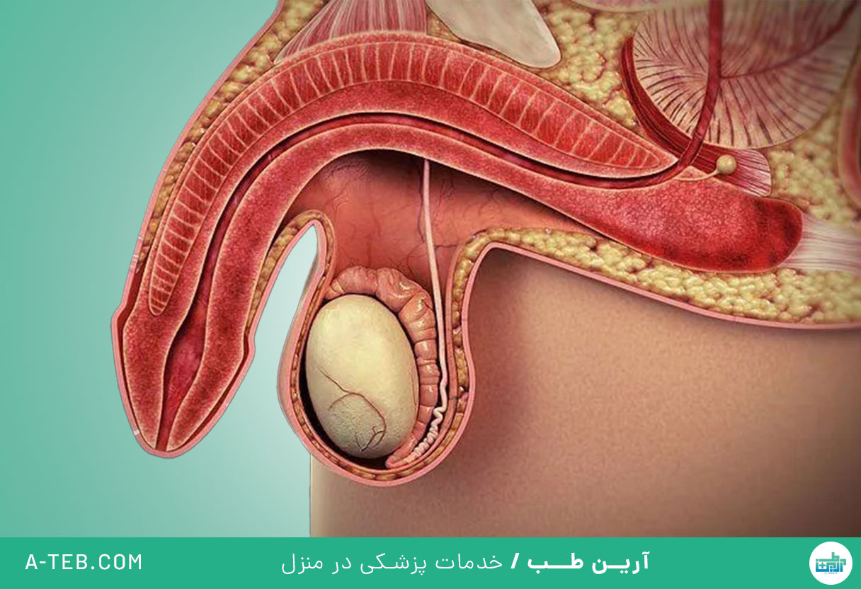 اختلال نعوظ