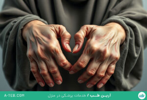 آرتریت روماتوئید