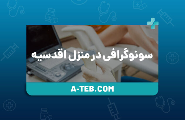 سونوگرافی در منزل اقدسیه