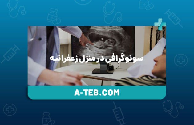 سونوگرافی در منزل زعفرانیه