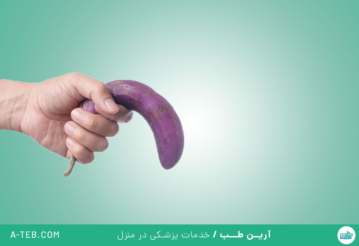 کجی آلت