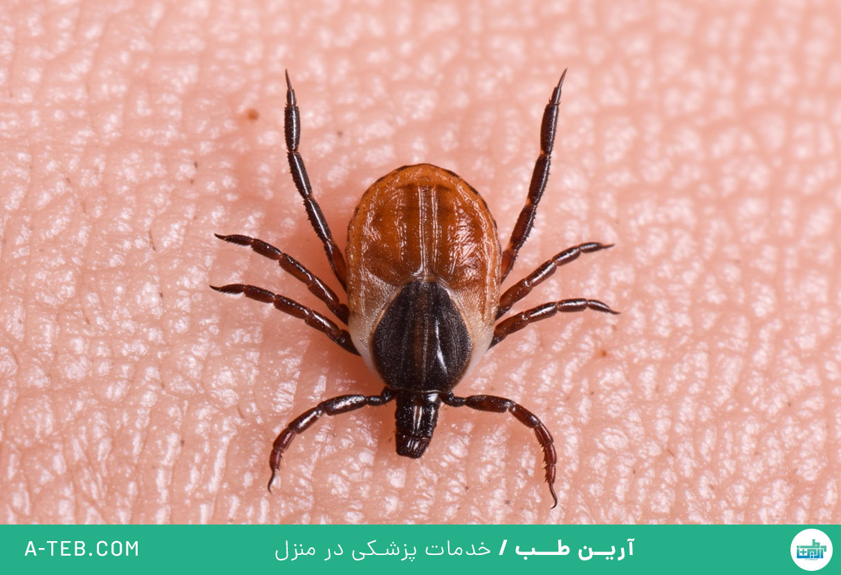 نیش حشرات