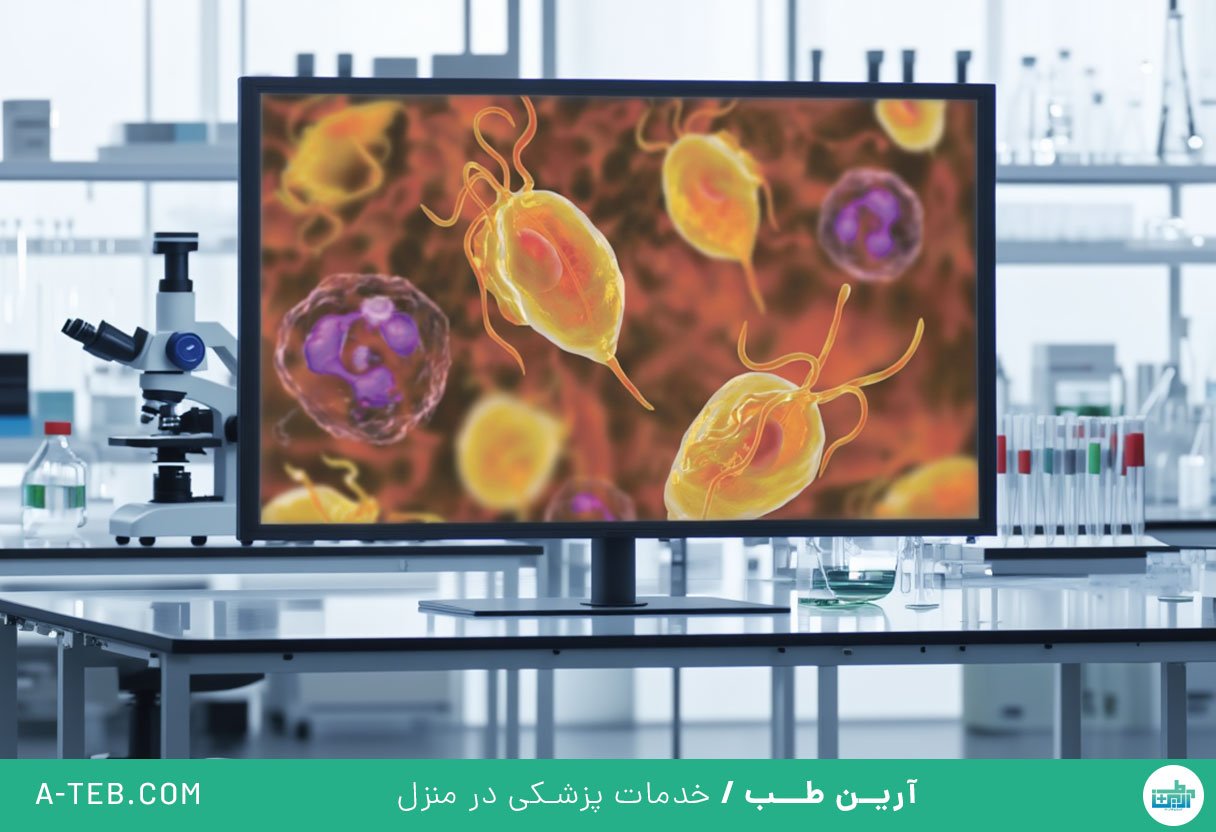 تریکومونیازیس