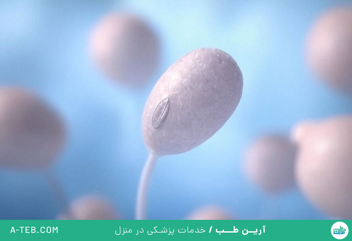 تریکومونیازیس
