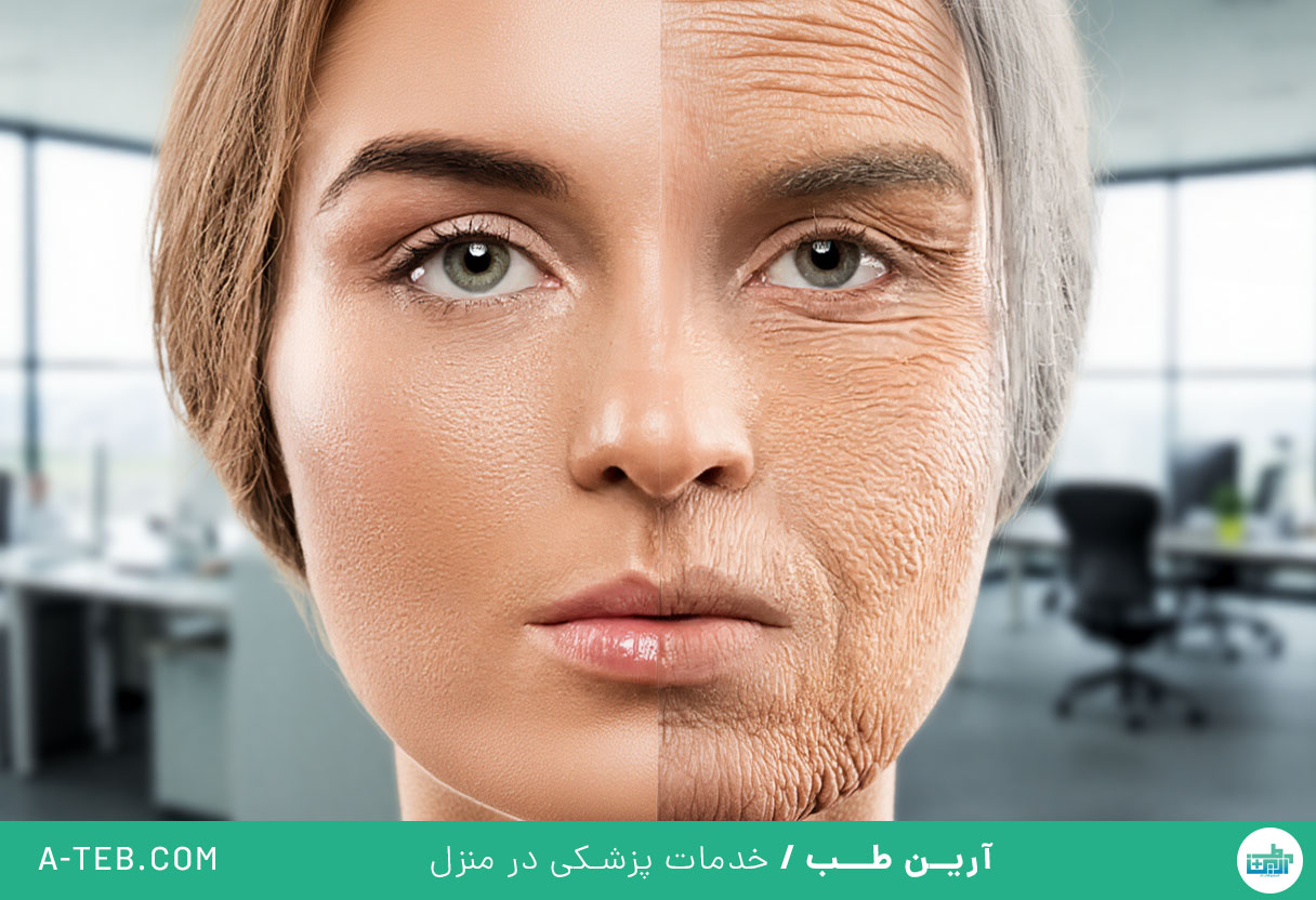 تاثیر سیگار کشیدن و سلامت پوست