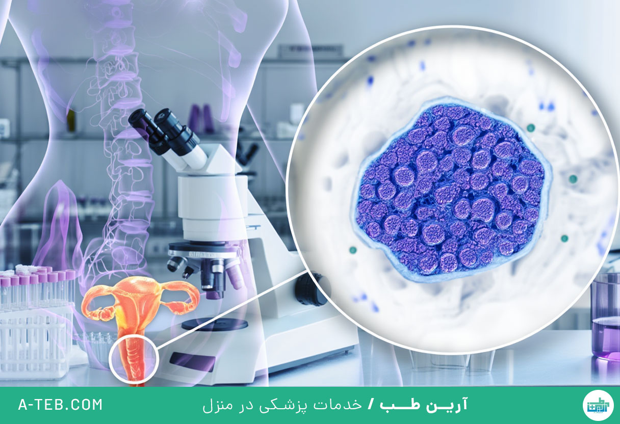 واژینوز باکتریایی