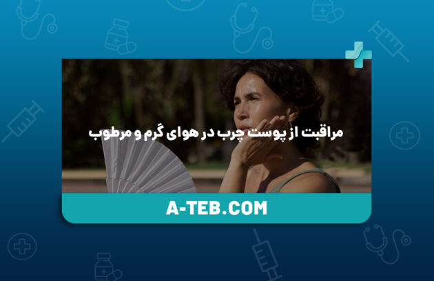 مراقبت از پوست چرب در هوای گرم