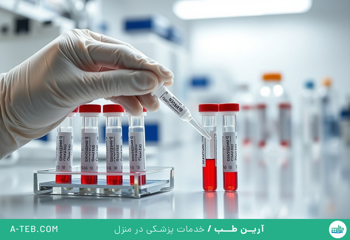آزمایش fbs