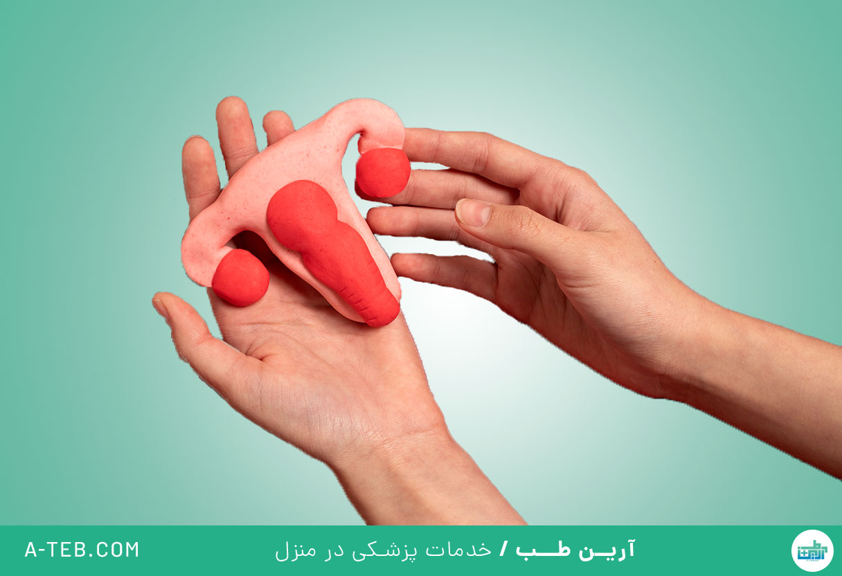 عفونت کلامیدیا
