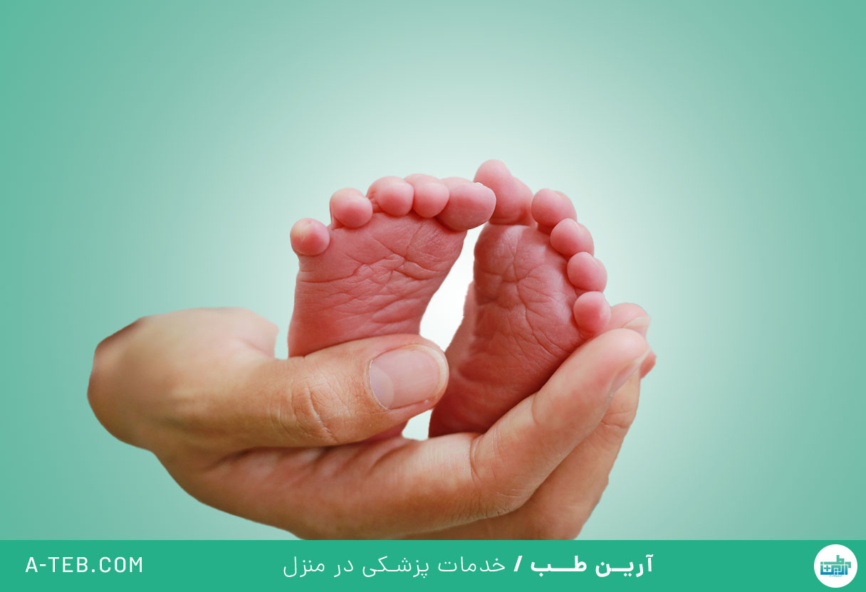 زایمان زودرس