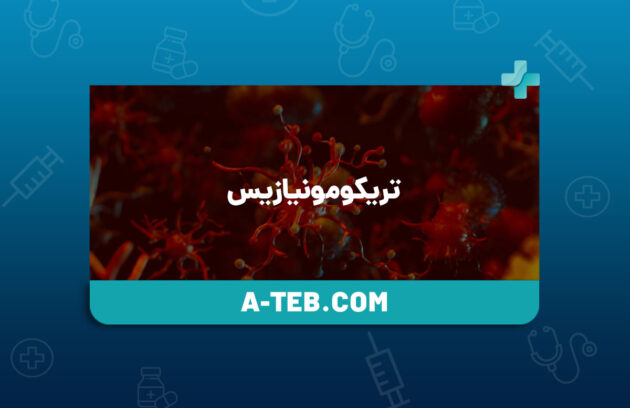 تریکومونیازیس