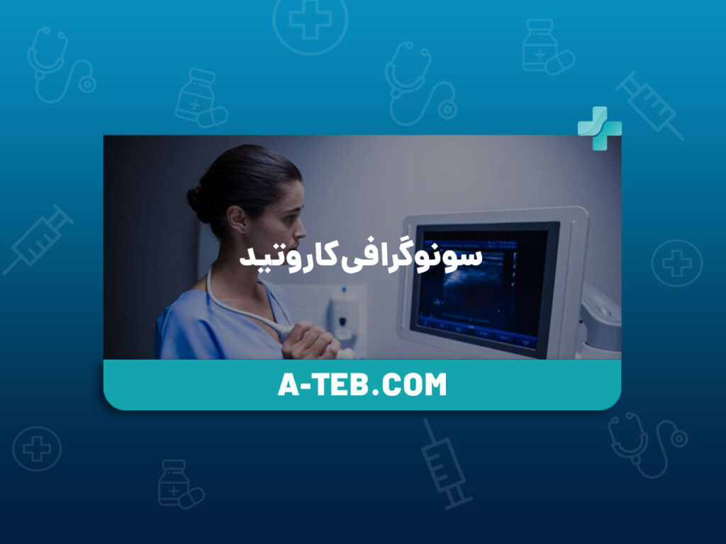 سونوگرافی کاروتید