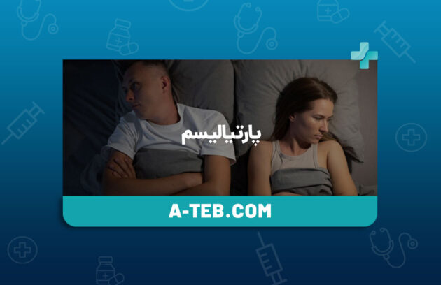 پارتیالیسم