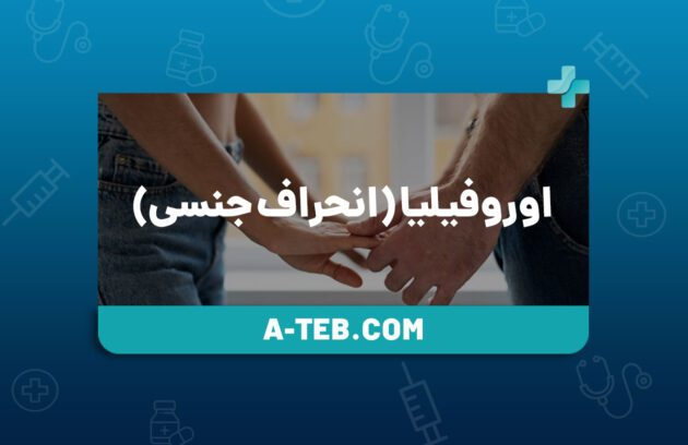 انحراف جنسی