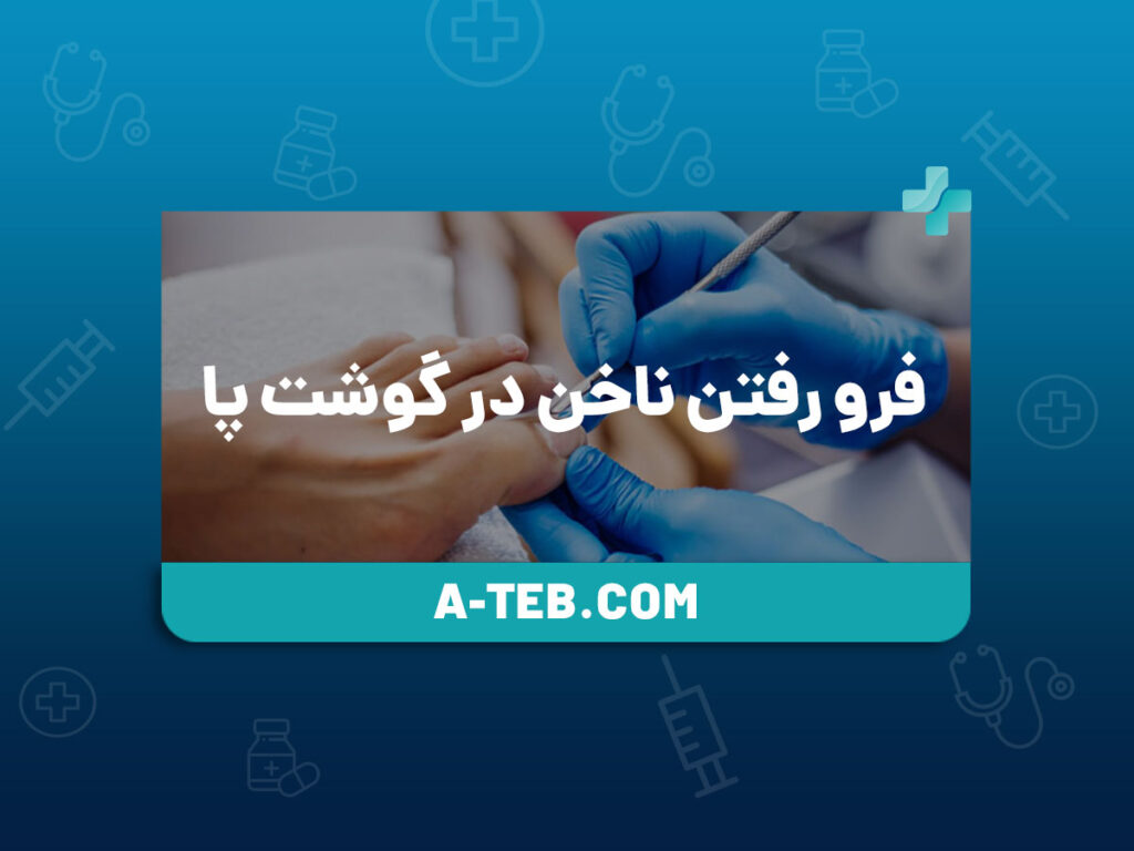 فرو رفتن ناخن در گوشت پا