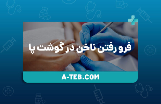 فرو رفتن ناخن در گوشت پا