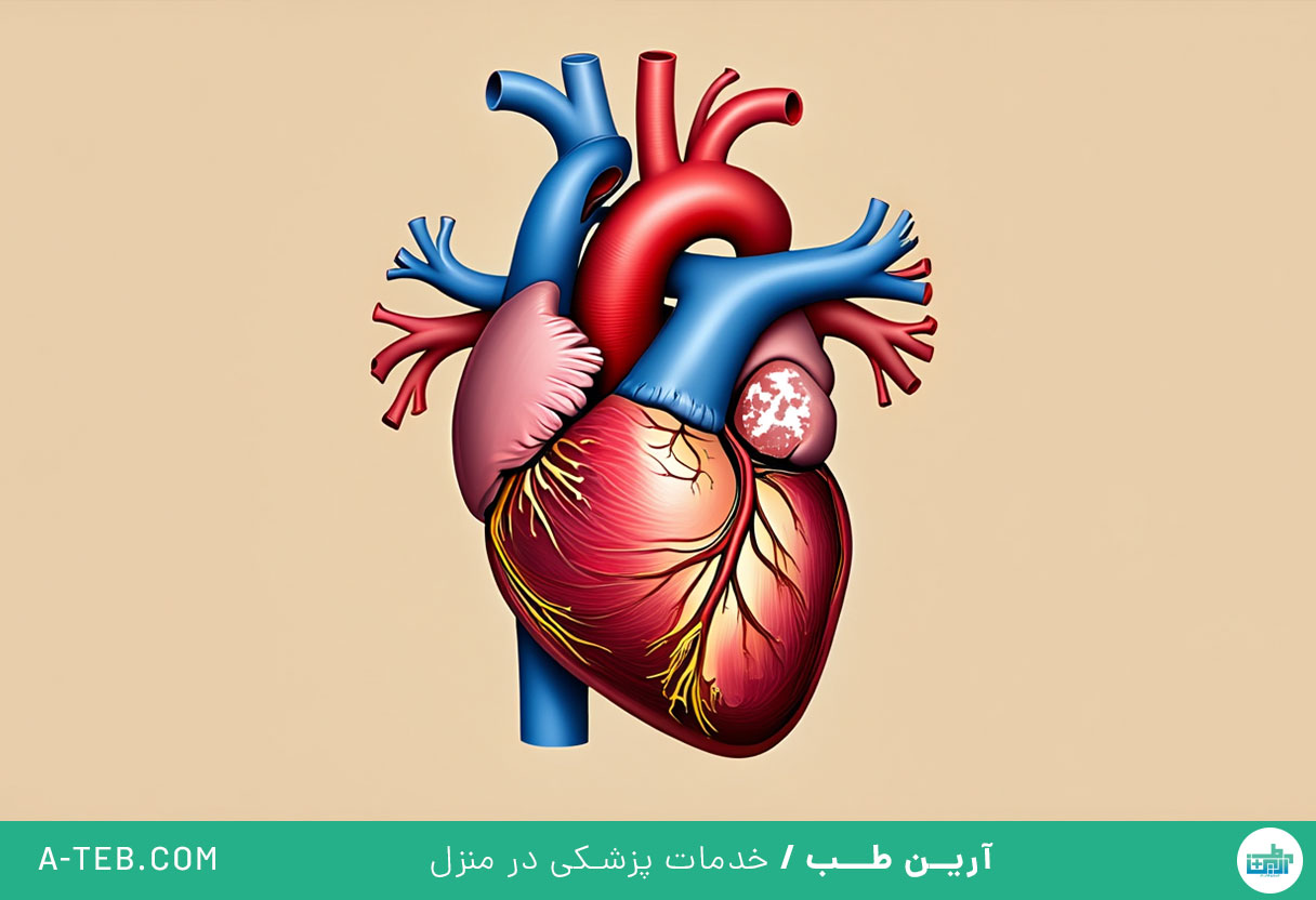 بیماری عروق کرونر