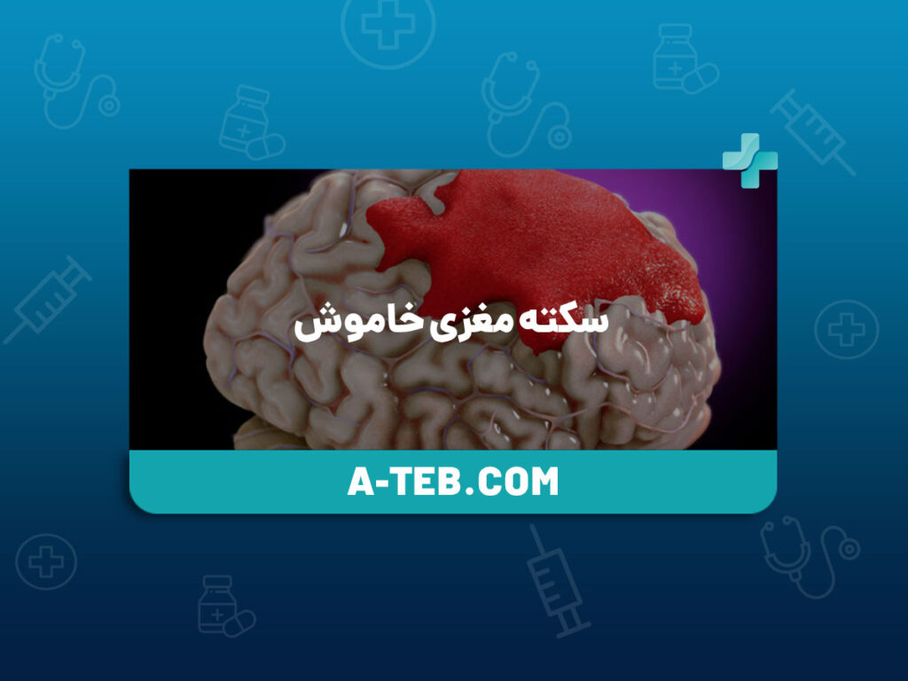 سکته مغزی خاموش