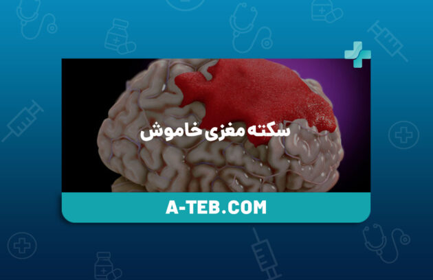 سکته مغزی خاموش