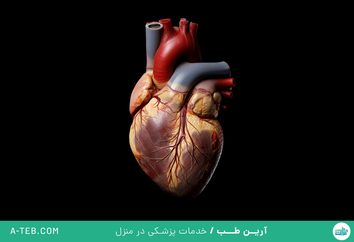 بیماری هیپرتروفی قلب