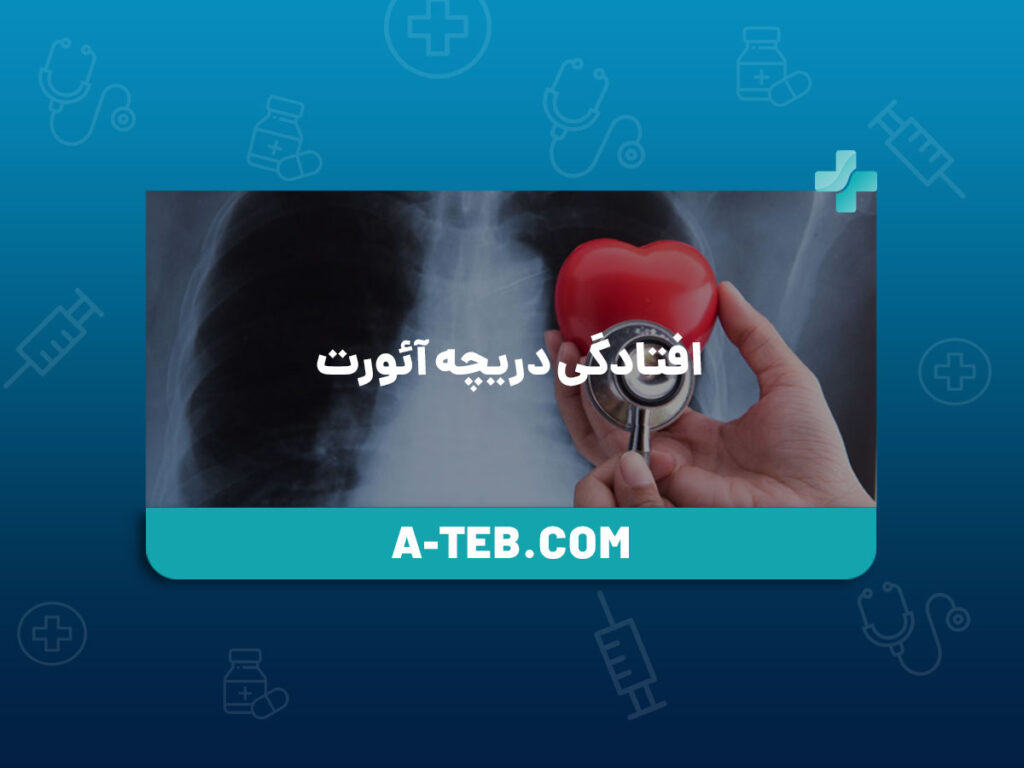 افتادگی دریچه آئورت