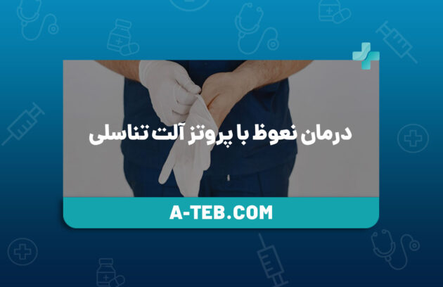 درمان نعوظ با پروتز آلت تناسلی