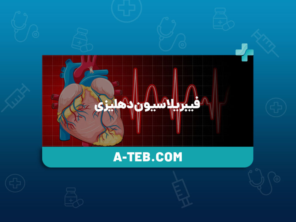 فیبریلاسیون دهلیزی