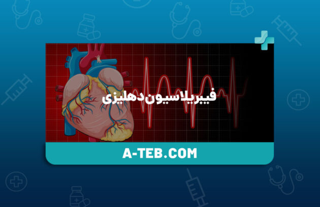 فیبریلاسیون دهلیزی