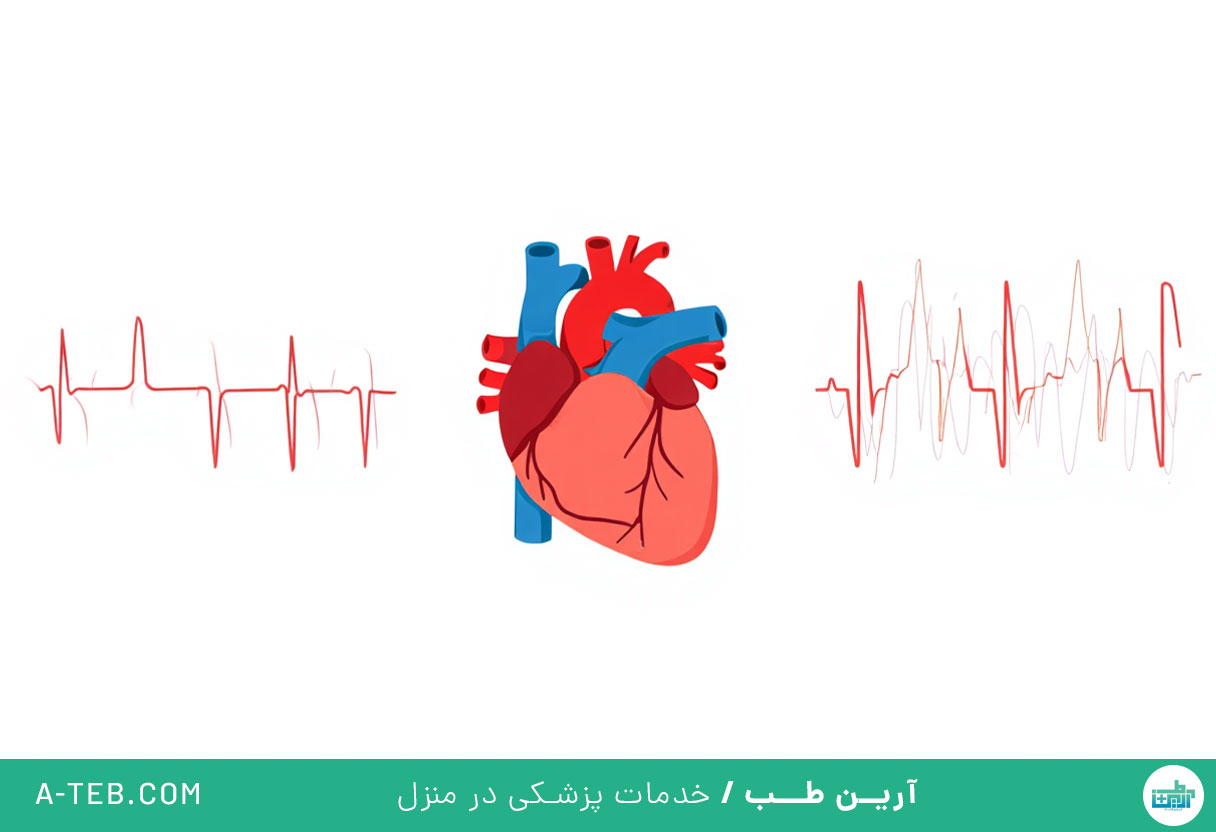 آریتمی قلبی