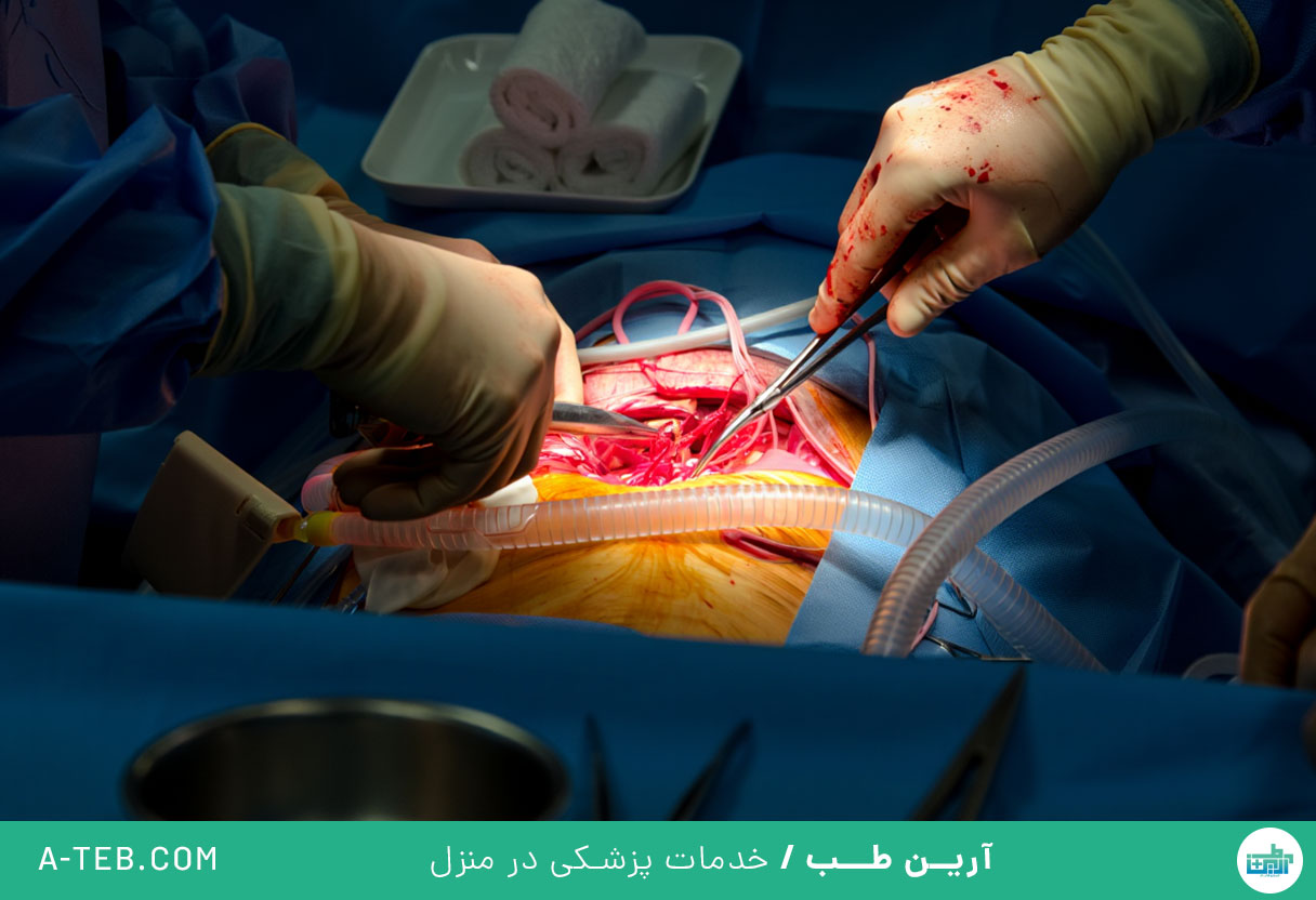 عمل قلب باز