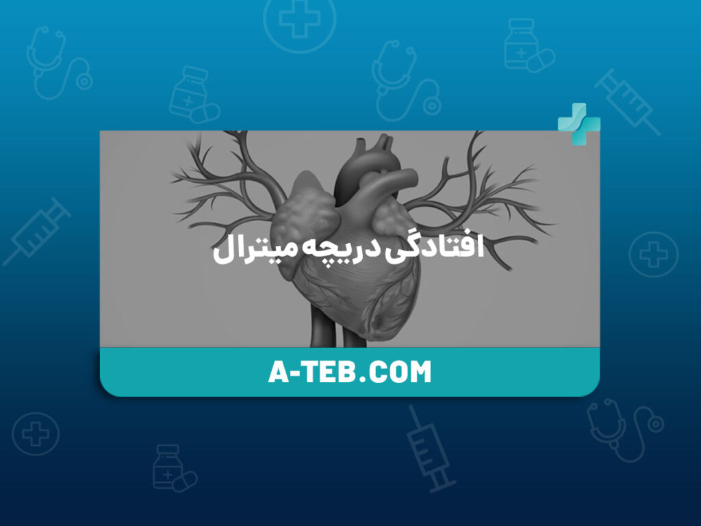 افتادگی دریچه میترال