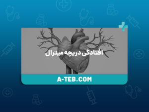 افتادگی دریچه میترال