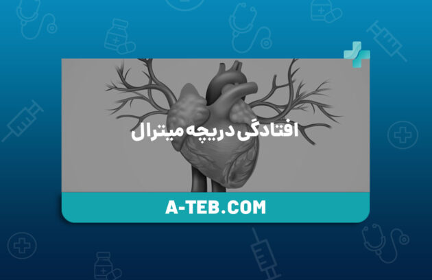 افتادگی دریچه میترال