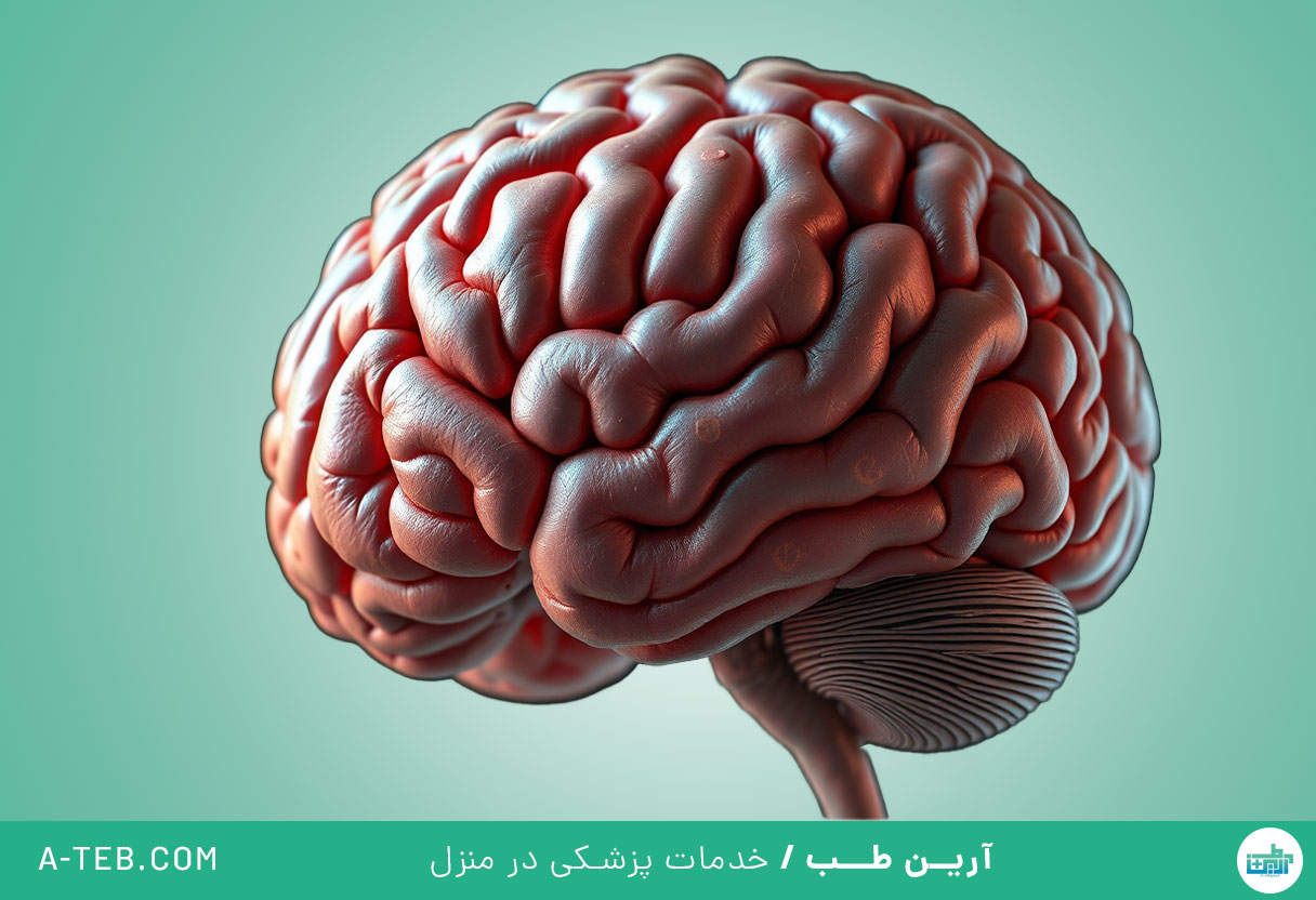 تومور مغزی