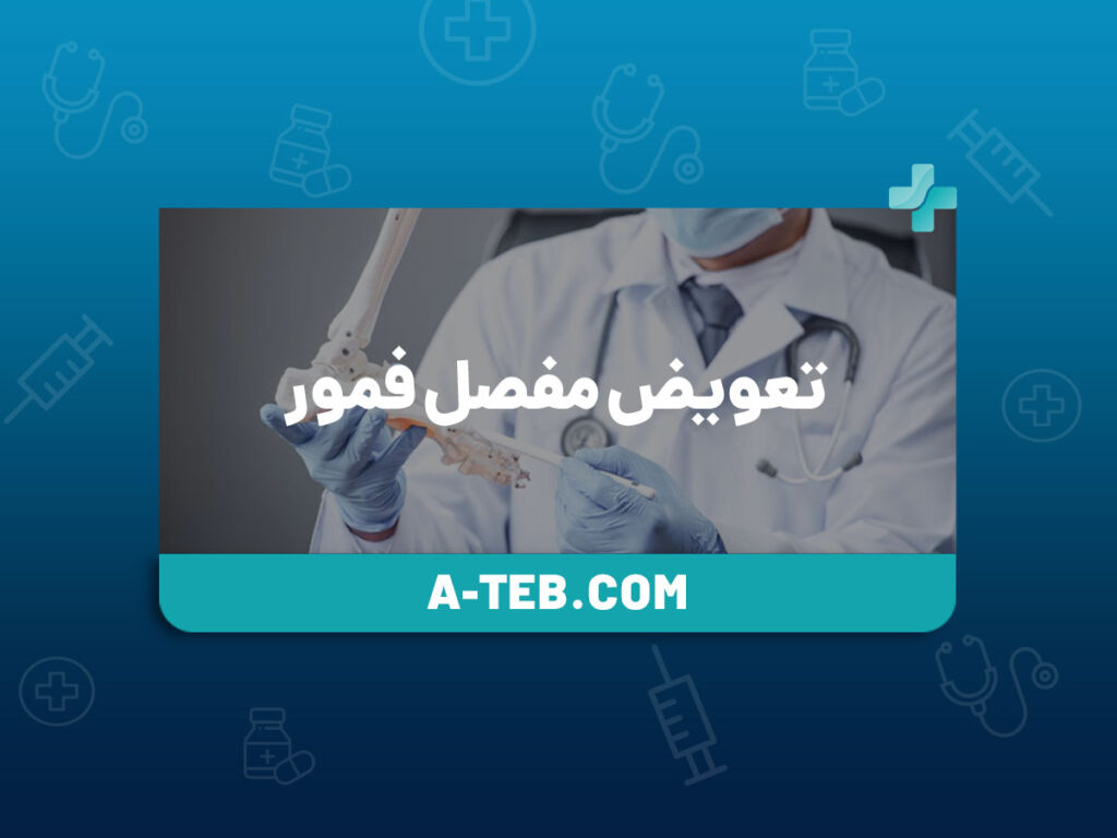 تعویض مفصل فمور